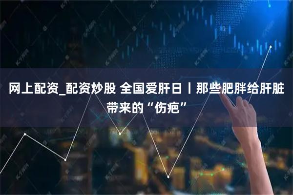 网上配资_配资炒股 全国爱肝日丨那些肥胖给肝脏带来的“伤疤”